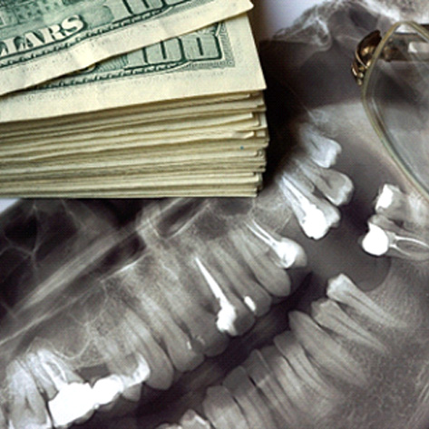Dollar bills and an x-ray, symbolizing the cost of emergency dentistry in West Loop