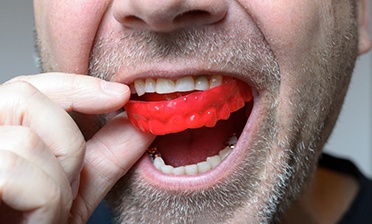 A close-up of a man using a red bite plate 