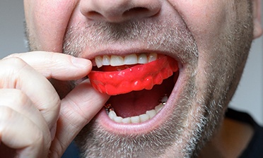 A close-up of a man using a red bite plate