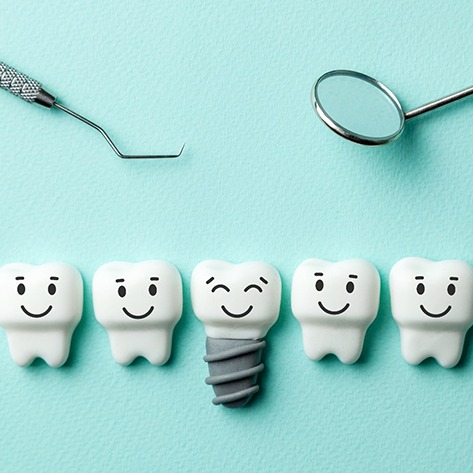 Illustration of dental implant in Chicago