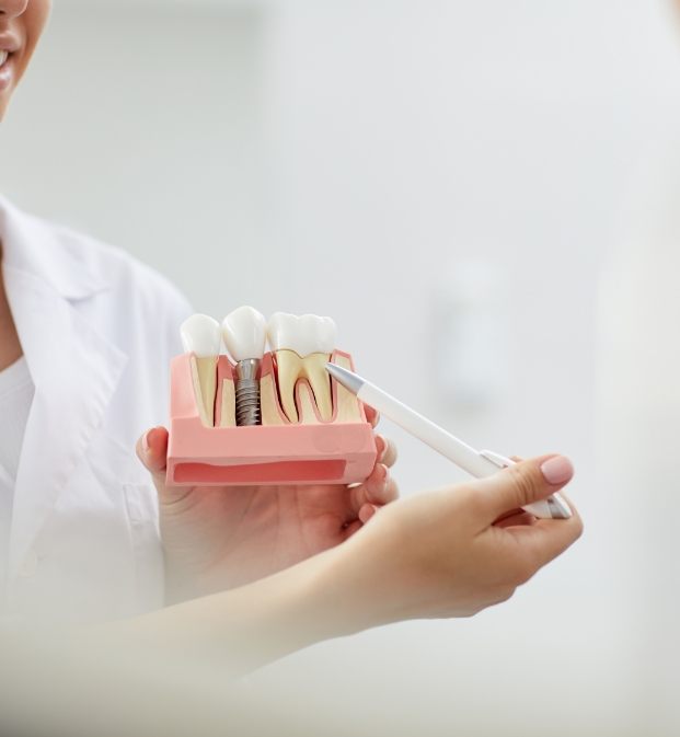 Dentist pointing to dental implant tooth replacement model