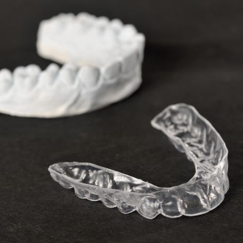 Clear nighguard for bruxism next to smile model