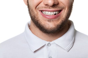 Bearded man smiling with a missing tooth