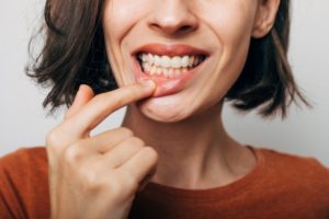 a person holding up their lip to show their gums