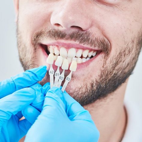 dentist giving a patient veneers in West Loop Chicago